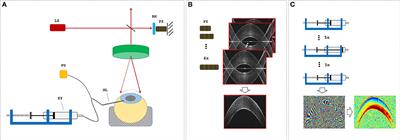 Optical Coherence Elastography-Based Corneal Strain Imaging During Low-Amplitude Intraocular Pressure Modulation